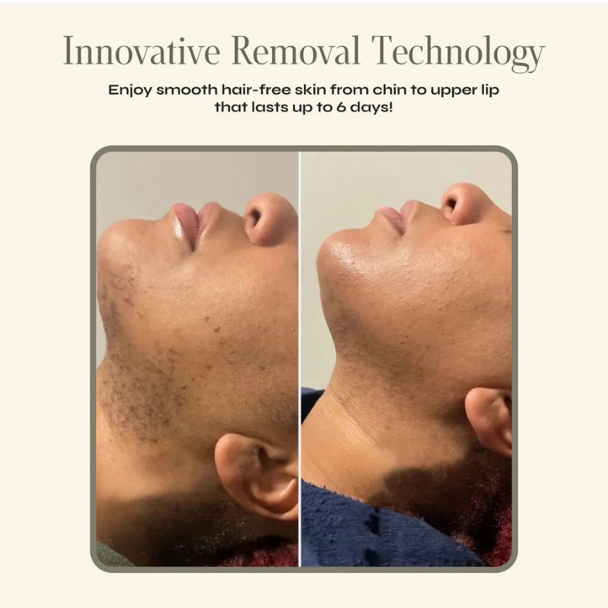 Facial Hair Removal Cream + Calming Serum